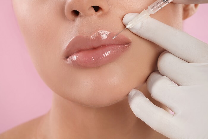 Dermal Filler San Diego