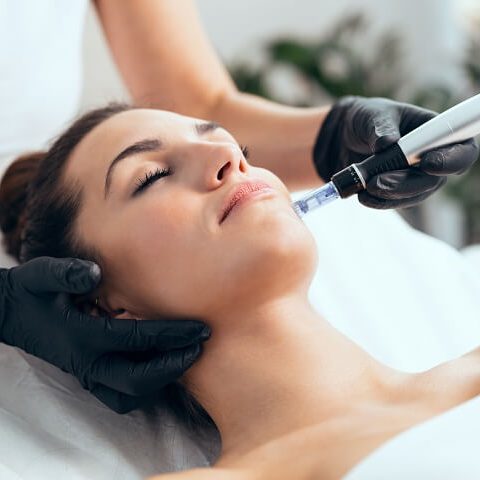 microneedling san diego