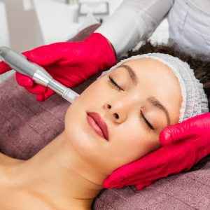 What age is best for microneedling